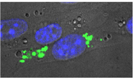 cellules cancéreuses